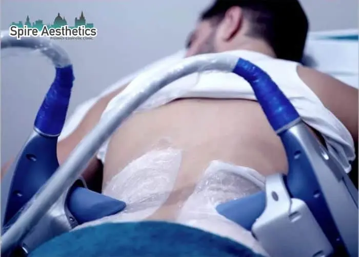 Man having fat freezing treatment done on love handles before a competitions Dudley to create a sculpted look.