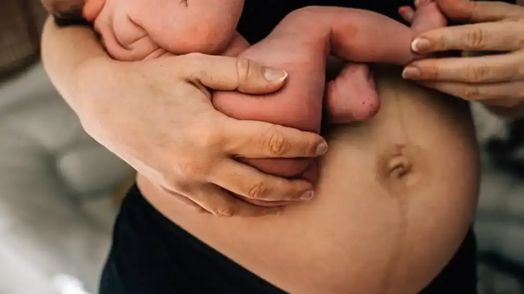 Why Is My Stomach Still Big After Pregnancy Dudley?